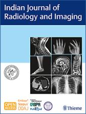 Isolated Superior Mesenteric Artery Dissection - By Dr Lalitha Palle